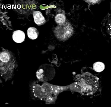 The perfect murder – Macrophage cell killed by T-cells