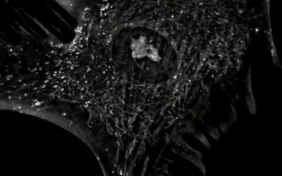 Human Mesenchymal Stem Cells in vivo: The Cytoskeleton