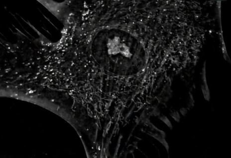 Human Mesenchymal Stem Cells in vivo: The Cytoskeleton