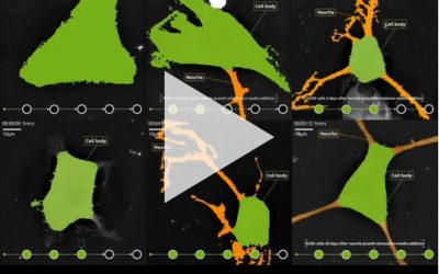 Watch Nanolive’s new webinar “Unlocking the mysteries of neurite growth in primary cortical neurones: a quantitative approach to live cell imaging”