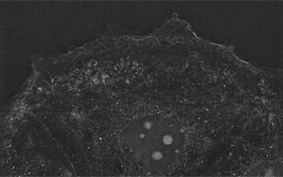 Food additives and gut health: new research from the University of Sydney