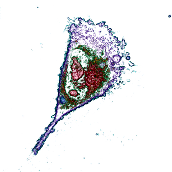Apoptosis live cell imaging - label-free
