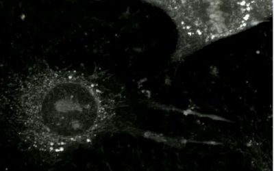 Tumor-derived extracellular vesicles uptake in mouse brain endothelial cells