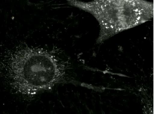Tumor-derived extracellular vesicles uptake in mouse brain endothelial cells
