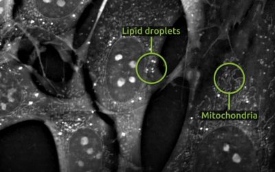 Can Nanolive cell imaging shed light on the link between valproic acid and steatosis?