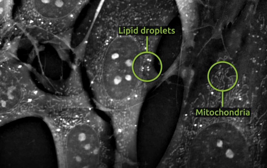 Can Nanolive cell imaging shed light on the link between valproic acid and steatosis?