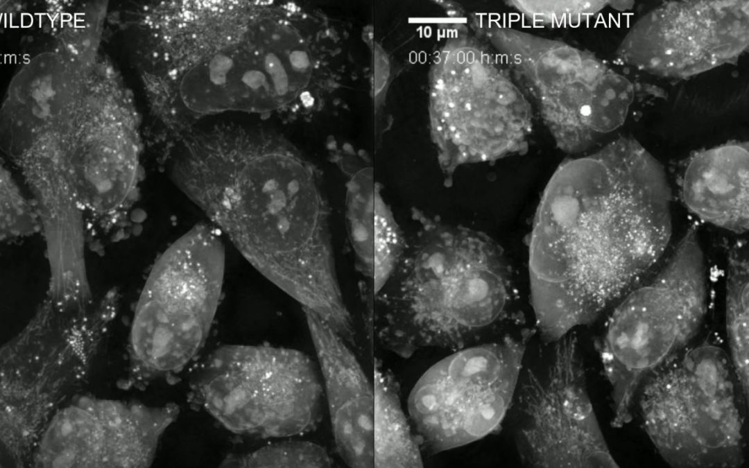 Nanolive imaging used to distinguish morphological traits of mutant cancer cells