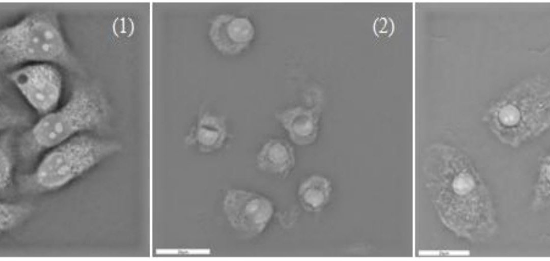 New publication: Quantification of changes in cellular morphology during cell necrosis obtained from 3D refractive index distributions