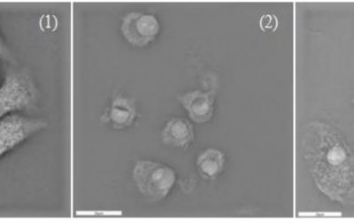 New publication: Quantification of changes in cellular morphology during cell necrosis obtained from 3D refractive index distributions