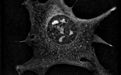 Nobel Prize goes to William G. Kaelin Jr., Sir Peter J. Ratcliffe and Gregg L. Semenza “for their discoveries of how cells sense and adapt to oxygen availability”