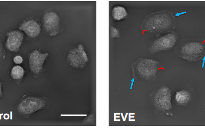 New publication: E-cigarette use increases susceptibility to bacterial infection by impairment of human neutrophil chemotaxis, phagocytosis and NET formation