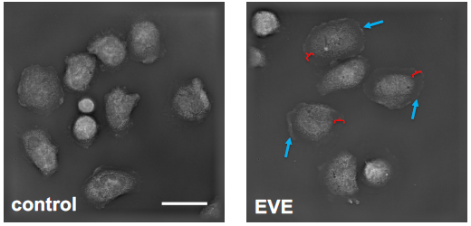 New publication: E-cigarette use increases susceptibility to bacterial infection by impairment of human neutrophil chemotaxis, phagocytosis and NET formation