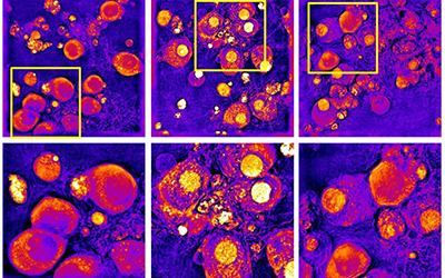 Towards a therapy to reduce damage after traumatic brain injury with Nanolive solutions