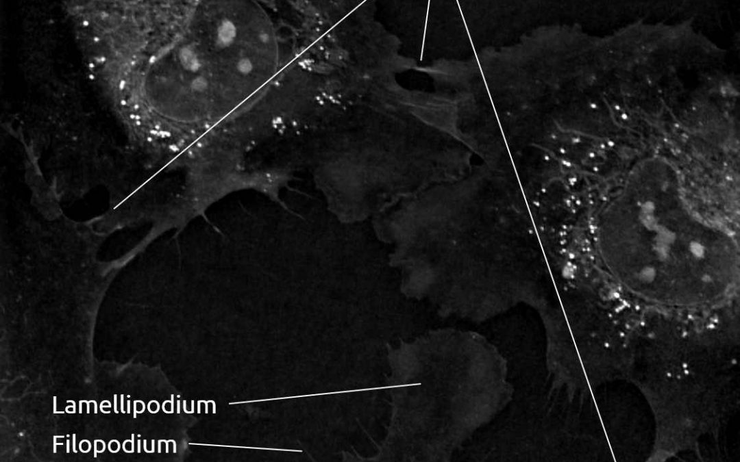 Protrusions in Human Umbilical Vein Endothelial Cells