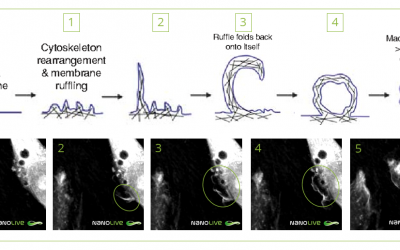 Protrusions in Human Umbilical Vein Endothelial Cells