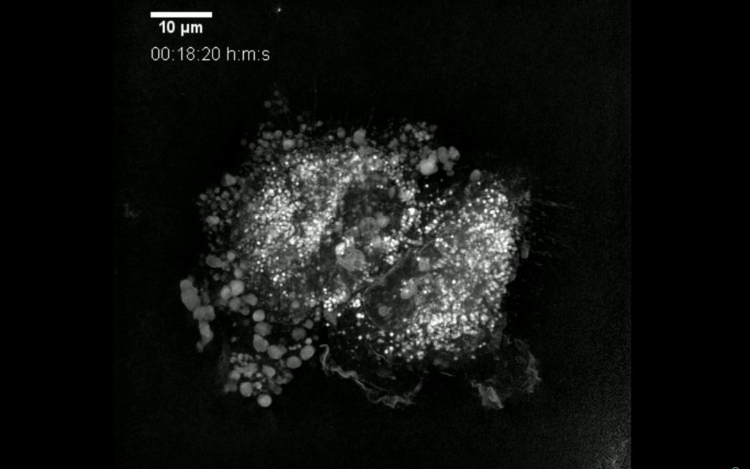 Can the use of saturated fatty acids improve lipid drug delivery systems?