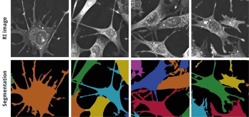 nanolive-eve-analytics-quantification-software Cell segmentations carried out from refractive index