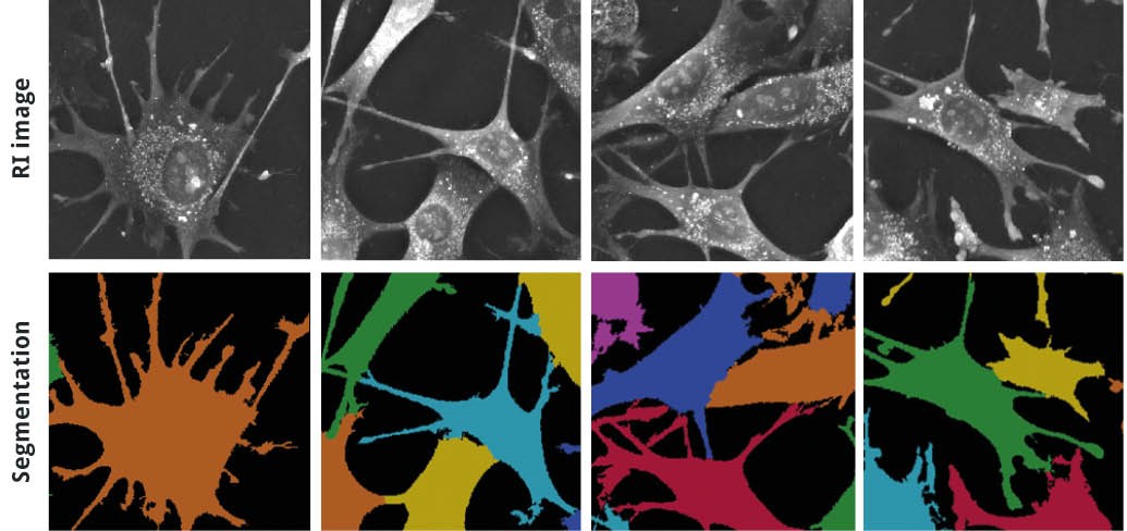 nanolive_eve_analytics_quantification_software Example cell segmentations carried out from refractive index (RI) holotomographic images.