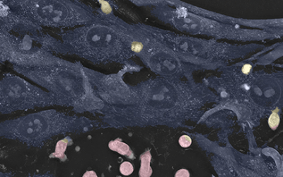 Testimonial: The Live T Cell Assay has the potential to revolutionize biopharmaceutical research