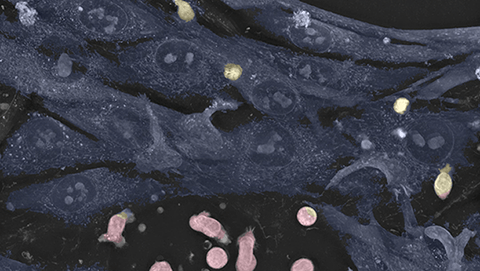 Testimonial: The Live T Cell Assay has the potential to revolutionize biopharmaceutical research