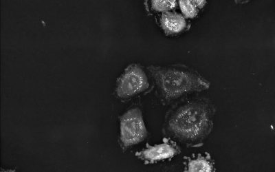 Exploring the potential Nanolive technology holds for phenotypic drug discovery