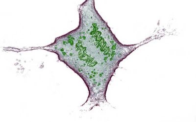 Undergrads! Win a one week microscopy project this summer in Switzerland: Scientist of Tomorrow 2019