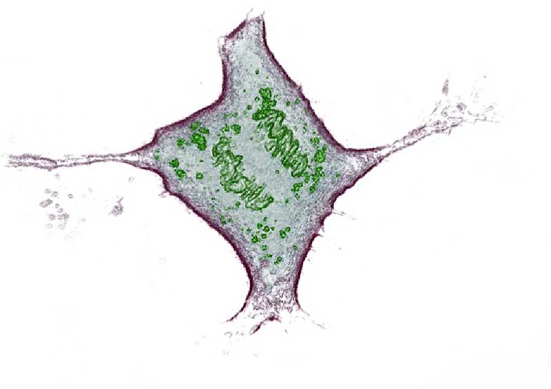Undergrads! Win a one week microscopy project this summer in Switzerland: Scientist of Tomorrow 2019